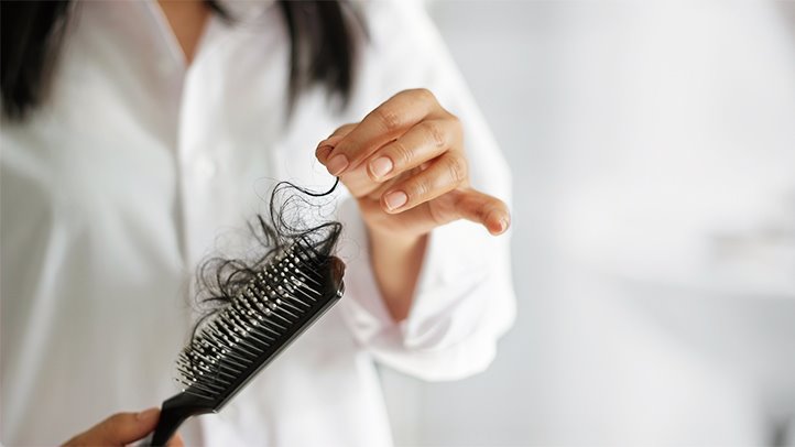 دلایل ریزش مو در زنان و راه های جلوگیری از آن
