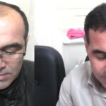 کاشت مو